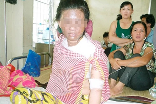 Vợ nằm võng, chồng dội cả nồi nước sôi lên người