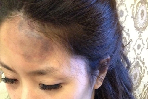 Người mẫu Hồng Quế bị tố đánh người