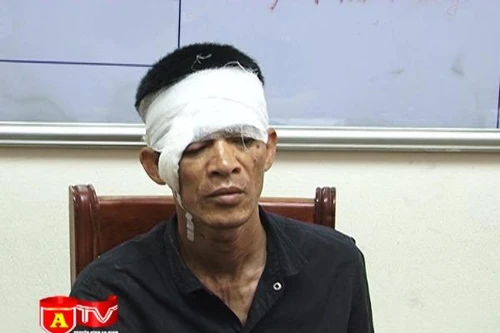 Đến thăm con, chém trọng thương bố vợ