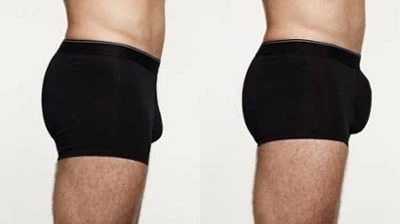 Kiện bệnh viện tắc trách khiến “cậu nhỏ” bị… liệt