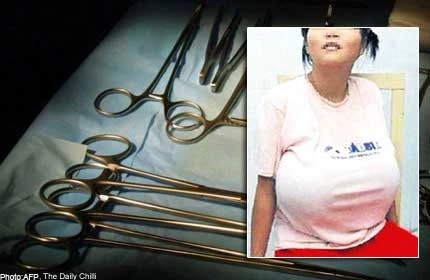 Phát khổ vì ngực khủng