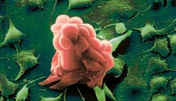 Phát hiện ra cơ chế ức chế sự di căn của tế bào ung thư