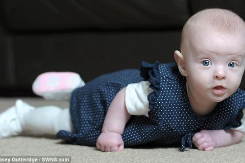 Bé gái “ma trắng”: Không có máu vẫn sống khỏe mạnh