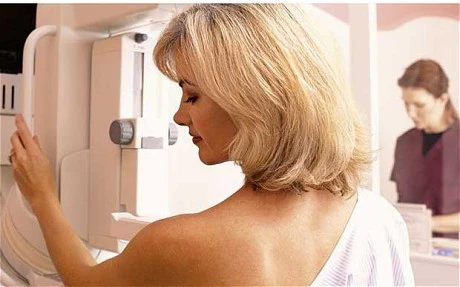 Sàng lọc giúp giảm 1/2 nguy cơ tử vong do ung thư vú