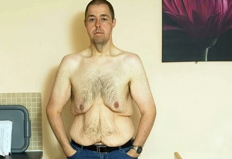 Không thể tìm được người yêu sau “thảm họa” giảm cân