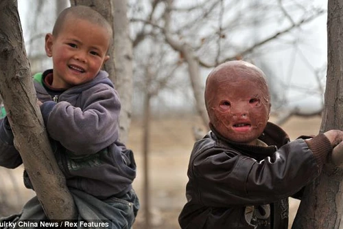 Đáng thương cậu bé không có mặt