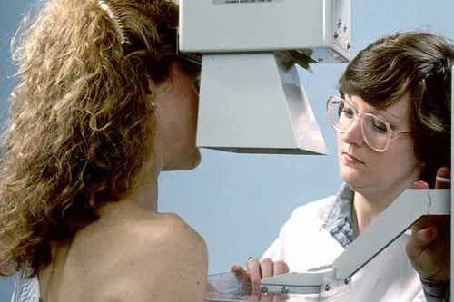 Nguy cơ tử vong do ung thư vú tăng theo độ tuổi