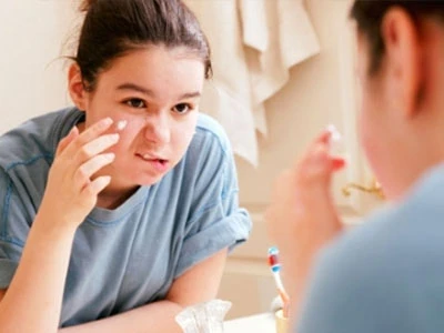 Giúp teen “đánh bay” mụn trứng cá