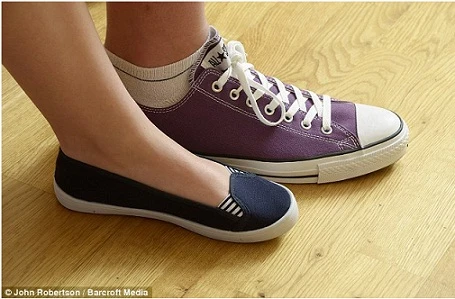 Cô gái có bàn chân “cỡ khủng”