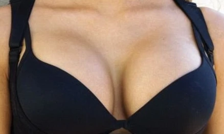 Chết hụt vì bộ ngực khủng của bạn gái