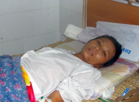 Rơi từ tầng 11, nữ công nhân thoát chết kỳ diệu