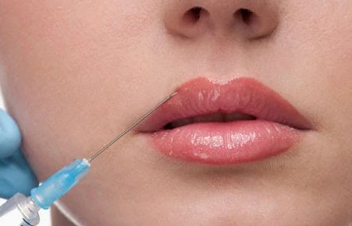 Đi thẩm mỹ tại cơ sở hành nghề "chui", thiếu nữ bị hoại tử toàn bộ môi dưới