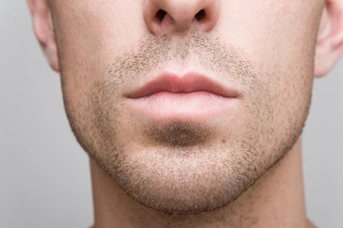 Nhiễm HPV miệng làm tăng nguy cơ ung thư đầu và cổ