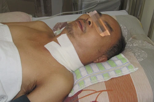 Sự thật về việc “suýt mất mạng vì ăn chay một tháng”