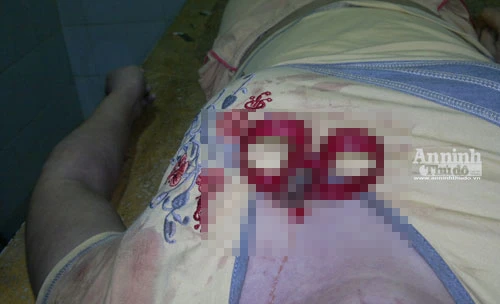 Đã bắt được kẻ đâm ngập chiếc kéo vào ngực cô gái trẻ