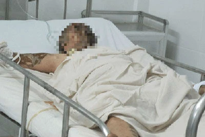 Tàn nhẫn hắt axít vào vợ vì sợ đẻ 6 con gái