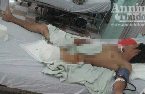 Kinh hoàng: Một người bị máy xay đá lạnh nghiến nát chân