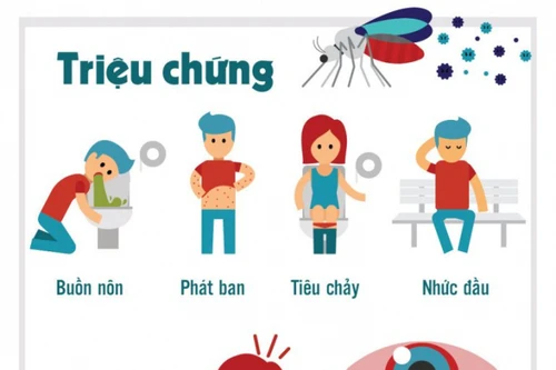 Sốt xuất huyết “vào mùa”: Phân biệt triệu chứng của bệnh với Covid-19