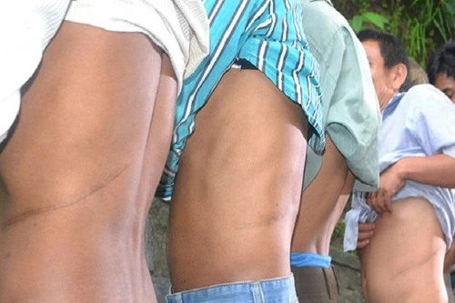 Ám ảnh những câu chuyện "bán thận xây nhà"