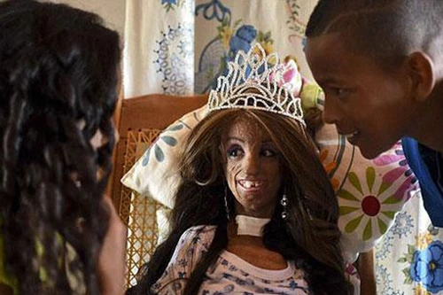 15 tuổi trông như bà cụ 90