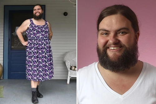 Cô gái tự tin hơn nhờ để râu