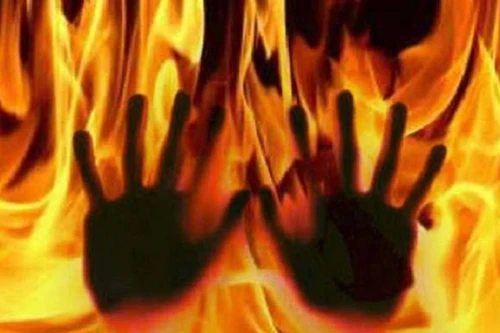 Bi kịch của một cô dâu Ấn Độ có làn da tối màu