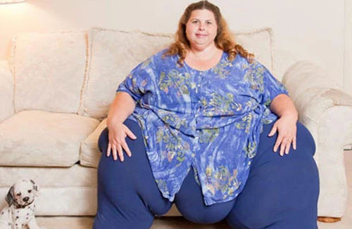 Khó tin: Người phụ nữ béo nhất thế giới vẫn “sex” 6 lần/ngày 