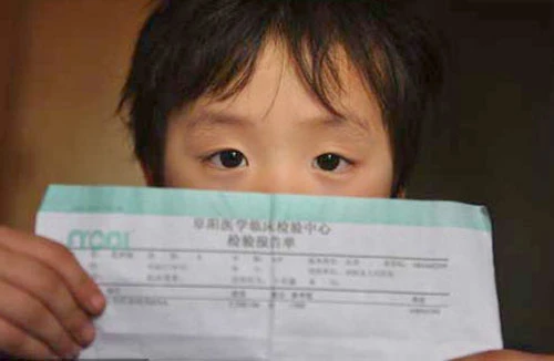 Nhiễm viêm gan C hàng loạt do bị tiêm chung kim