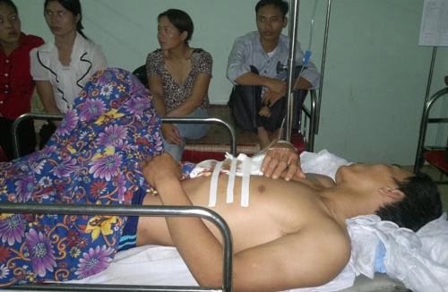 Chủ bị thương vì hai trâu nhà húc nhau