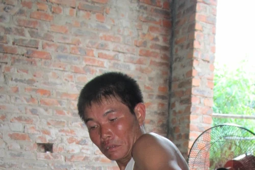 Người chống tham nhũng bị kẻ lạ mặt tấn công