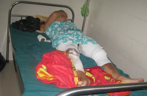 Chồng tàn bạo hắt thẳng chảo dầu sôi vào vùng kín của vợ