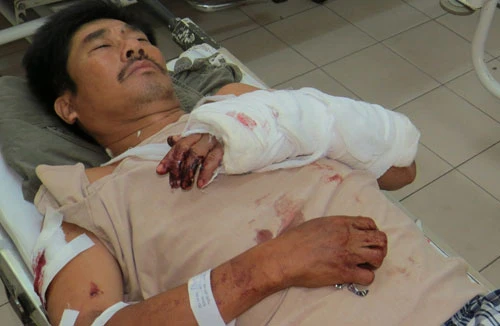 Trạm trưởng bảo vệ rừng bị chém lúc rạng sáng