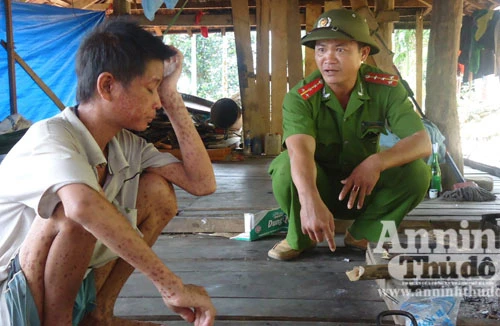 Thâm nhập làng "bệnh lạ" ở Ba Điền