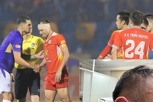 Khán giả V-League cảm phục “chiến binh” Trọng Hoàng