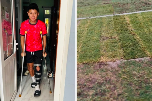 Cầu thủ V-League đứt dây chằng sau trận đấu trên sân Mỹ Đình