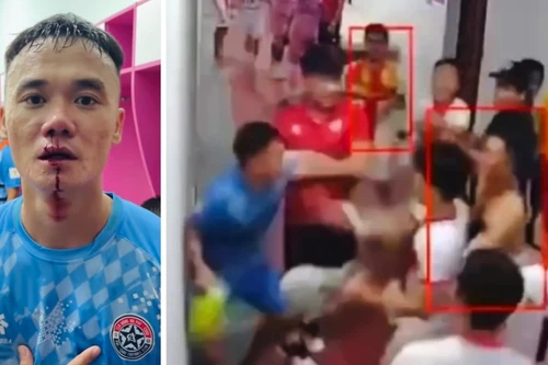 Clip: Đánh nhau ở giải hạng Nhất, cựu tuyển thủ chảy máu mũi