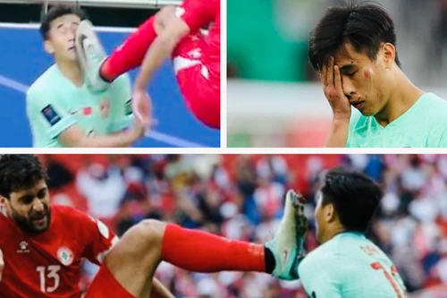 Cầu thủ Trung Quốc mặt rớm máu vì lĩnh trọn gầm giày của đối phương