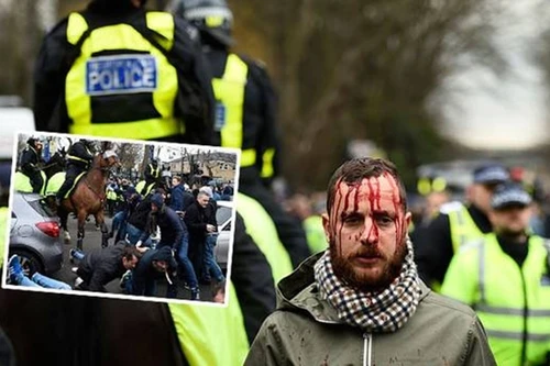 Một CĐV bị "tắm máu" trước trận derby London