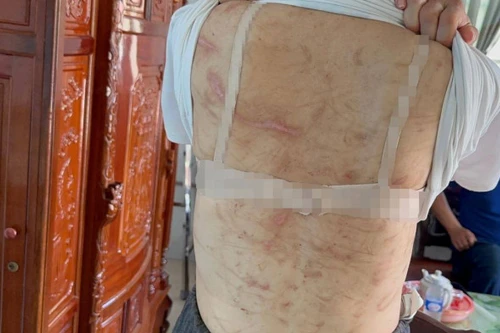 Sắp tới, Chủ tịch xã có quyền đề nghị xử lý hình sự người chồng bạo hành vợ?