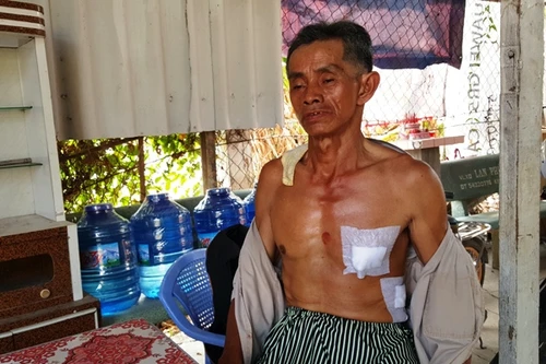 Lái xe ôm giả chết sống sót thần kỳ dưới lưỡi dao 2 tên cướp