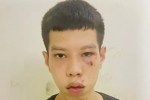 Nhanh chóng bắt giữ đối tượng cướp giật túi xách của cụ bà vừa lĩnh lương hưu