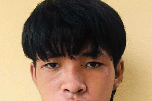 Khởi tố bị can đâm xe vào chiến sỹ Công an tại chốt phòng chống Covid-19 