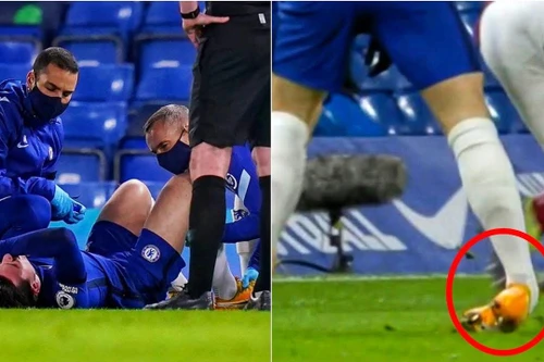 Chilwell chấn thương nặng, Chelsea thắng mà lo