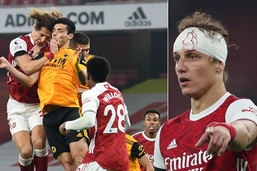 David Luiz khiến đối phương nứt hộp sọ sau pha va chạm kinh hoàng