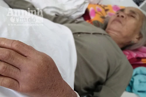 Đã có hơn 140 người nhập viện vì bị rắn lục đuôi đỏ cắn