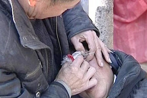 Người phụ nữ Trung Quốc khóc... ra đá to bằng hạt đậu tương