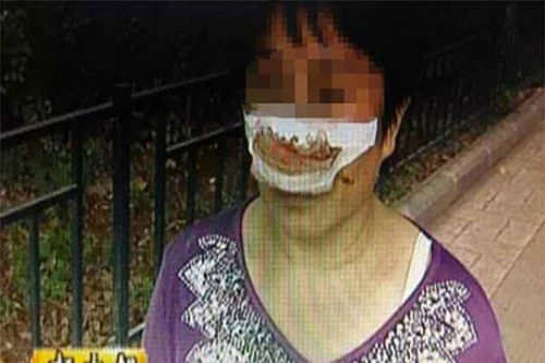 Chống cắn nát và nuốt chửng mũi vợ chỉ vì không trả lời điện thoại