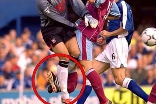 Những chấn thương kinh hoàng gây chấn động thế giới bóng đá