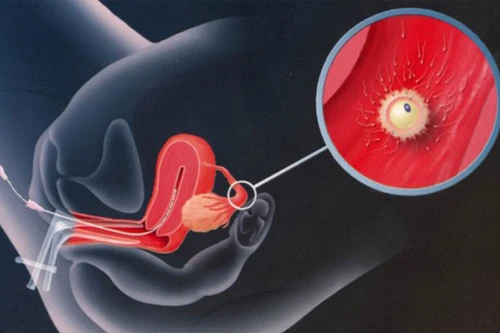 Sản xuất tinh trùng trong ống nghiệm