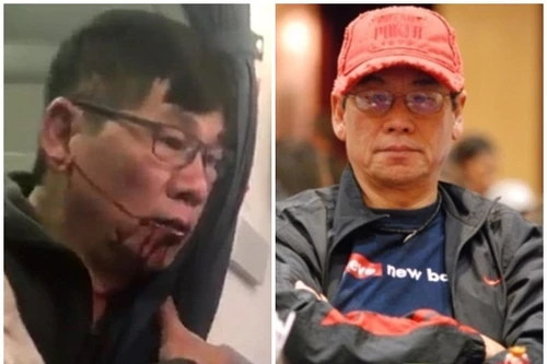 Lôi xềnh xệch bác sĩ gốc Việt, hãng hàng không Mỹ mất cả tỷ đô-la